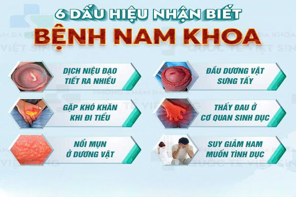 Hình ảnh minh họa